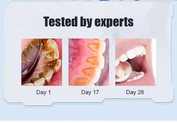 12a71dbe41e37df93f063d8d854842c391a64318